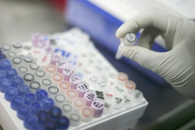 72429099-630x420 DNA Test