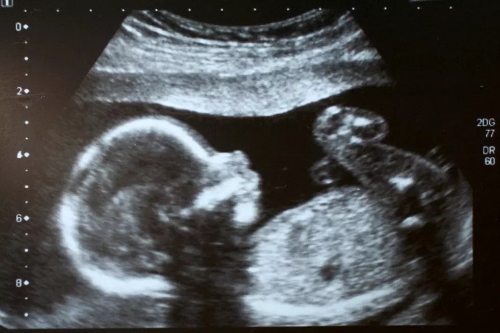 Banner’s Wyoming Medical Centers and Clinics Receive $1.8M for Ultrasound Equipment